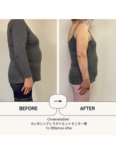 オーシャン整骨院(OCEAN整骨院)/ダイエット６ヶ月コース