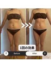 エイミー 藤ヶ丘店(Amy)/before→after