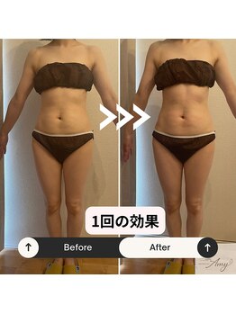 エイミー 藤ヶ丘店(Amy)/before→after
