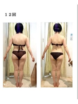 リッチ(Riche)/お任せ痩身ビフォーアフター