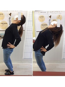 べっぷ餅ヶ浜整体院/美骨歪み矯正before/after