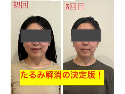 アリエス(Aries)の写真