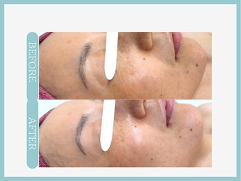 スリムライン 秋田店(The Slim Line)/before→after