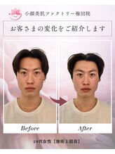 小顔美肌ファクトリー 梅田院/