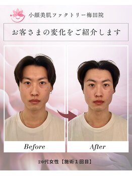 小顔美肌ファクトリー 梅田院/