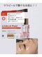 スールボーテ(soeur beaute)の写真/艶肌とハリを追求！韓国の最新技術ララピールで、あなたも憧れの美肌へ★