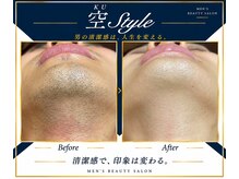 空スタイル(空STYLE)の雰囲気（メンズ脱毛/vio/全身/光フェイシャル/ハーブピーリング/毛穴洗浄）