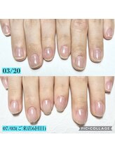 シャルム 本厚木(charme)/自爪育成ジェルコース