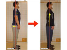 リファイン(Refine)/座り仕事で股関節が固まっている