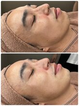 ユーイン 塩尻店(U-in)/ララピールビフォーアフター