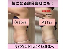 お腹、二の腕、太ももの痩身が人気です！