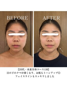 ヨサパーク フェリシア 西荻窪(YOSA PARK Felicia)/短期期間で集中ダイエット!