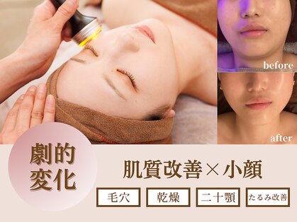 ミスティア(mistia)の写真