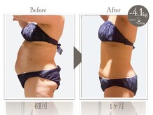 ビューティーリバース 二俣川店/★劇的ビフォーアフター★