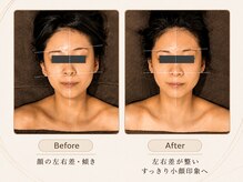 オーバイワン 自由が丘本店(Oby1)の雰囲気(顔の左右差が整い、フェイスラインがよりすっきりした小顔印象へ)
