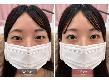 アーツ アイサロン 町田店(arts eyesalon)の写真/一重・奥二重の重い瞼にお悩みの方へ。特許技術の二重ストレッチカールで魅力UP◎