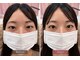 アーツ アイサロン 町田店(arts eyesalon)の写真/一重・奥二重の重い瞼にお悩みの方へ。特許技術の二重ストレッチカールで魅力UP◎