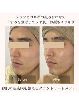 アディス 心斎橋(ADISE)/タラソトリートメント×コルギ