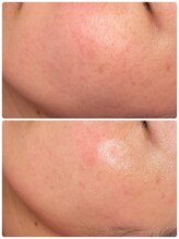 ヒメミ(Himemi)/艶肌Wax