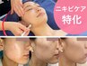 【本気のニキビ改善/No.1韓国肌管理】ごっそり毛穴洗浄+ニキビケアピーリング