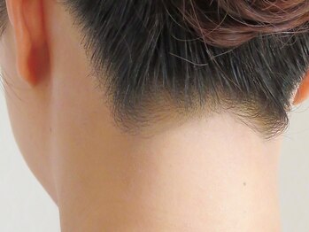 アヴェーラ(Avela)の写真/【襟足脱毛＋顔脱毛￥3900】後ろ姿が気になり好きな髪型ができない…今年こそアップスタイルでも自信を◎