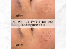 ベーヤ(Bella)の雰囲気（ハーブピーリングで肌質改善！しみ、しわ、ニキビ、お肌代謝促進）