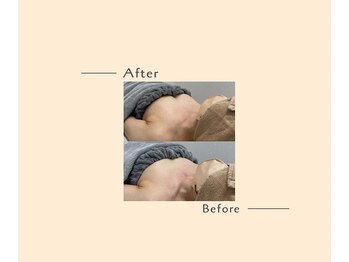 オベリオ(OBERIO)/