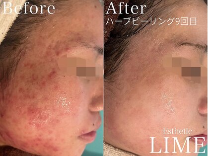 ライム 松本(LIME)の写真