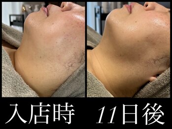 ビーエルティー(blt)/レモンボトル