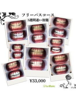 ルブラン 奈良店(Le Blanc)/通うほどお得な通い放題！