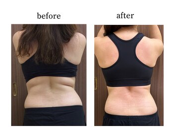 ウィズマツオカ 光の森店/脂肪撃退ダイエットマシーン