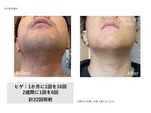 ケーナイン(K-9)/毛量・濃さに合わせて丁寧に施術
