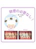 【喫煙者の方】ヤニ取りケア＋ホワイトニング15分×2回照射￥9,930→￥6,980