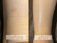 テミシア(TEMISIA)/溜め込み排出キャンペーン♪