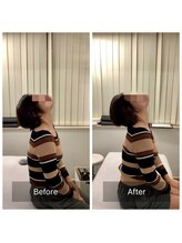 ナオル整体 新宿院(NAORU整体)/30代女性-猫背矯正Before/After