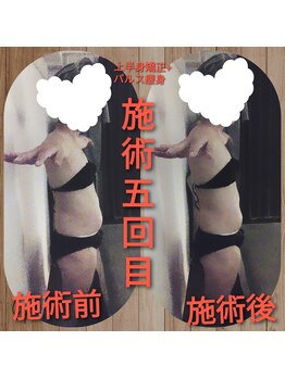 ほしにはろー/パルス痩身5回