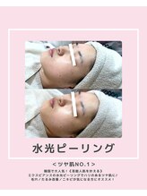 ソワナ(soina)/【神楽坂駅/フェイシャル/毛穴】