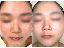 ウォナ(WONA)/【お客様症例】