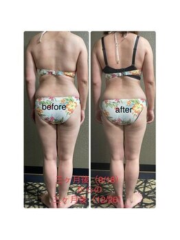 チュラ/ハイパーナイフ/所沢/痩身エステ