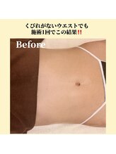 プレジール エテ(plaisir Ete)/くびれがないウエストでも