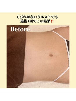 プレジール エテ(plaisir Ete)/くびれがないウエストでも