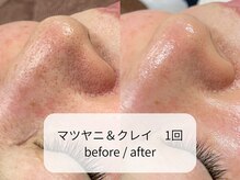 ヴィーヴォ(Vivo)