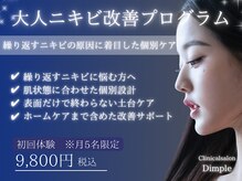 ディンプル(Dimple)