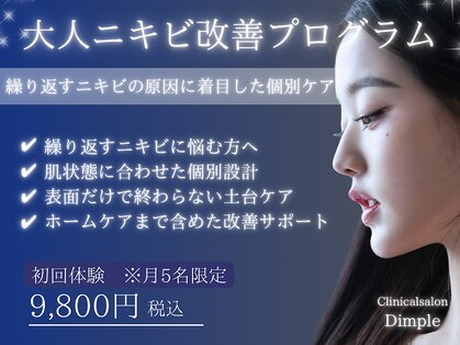 ディンプル(Dimple)の写真