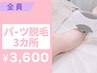 【都度払い☆プチ脱毛】パーツ脱毛３ヶ所 ¥3,600 