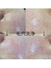 コウ鍼灸院(KOH鍼灸院)/