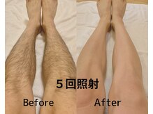 バディーズ(BUDDieS)/施術者本人