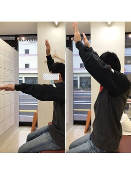 べっぷ餅ヶ浜整体院/美骨歪み矯正before/after