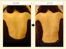 そくわんショウの方、初回で腰痛改善、背骨弯曲も緩和しています