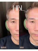 ナルム(naluM)/ハリウッドブロウリフト/HBL